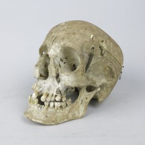 Human skull 3